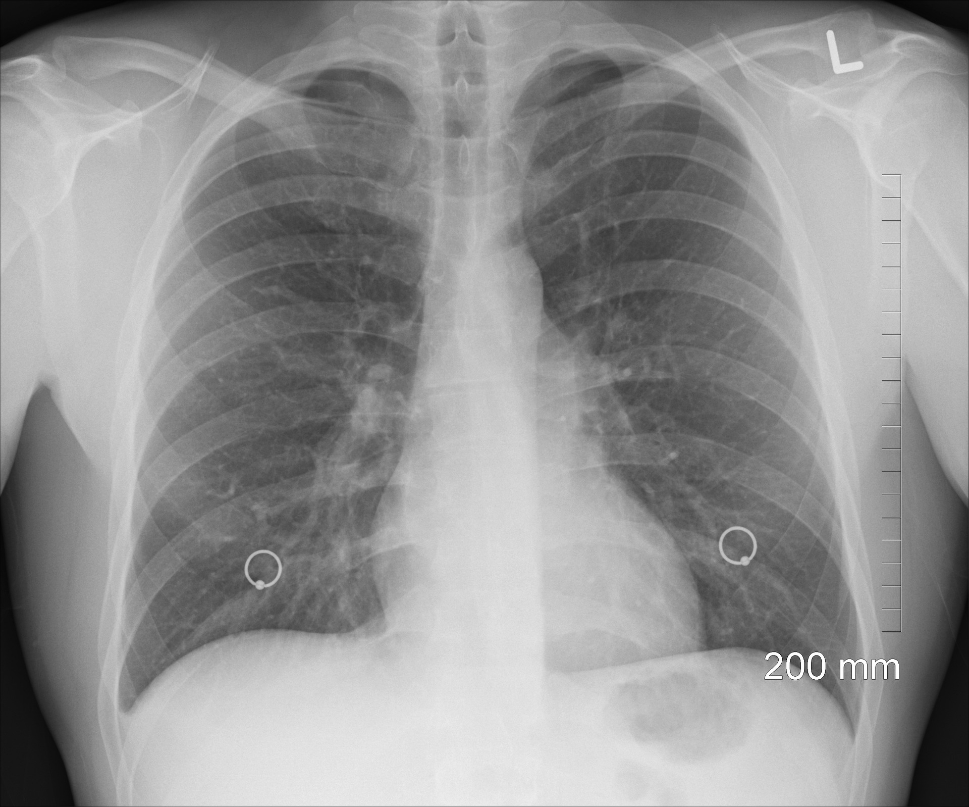 HealthTech Industry Update | The Robot Surgeon You Can Swallow