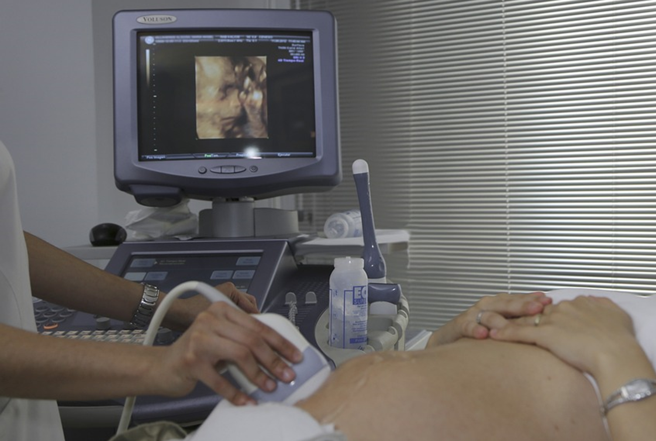 HealthTech Industry Update | AI-enhanced ultrasound for women’s health